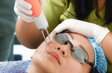 Things To Know About Face Lifting How Much Singapore